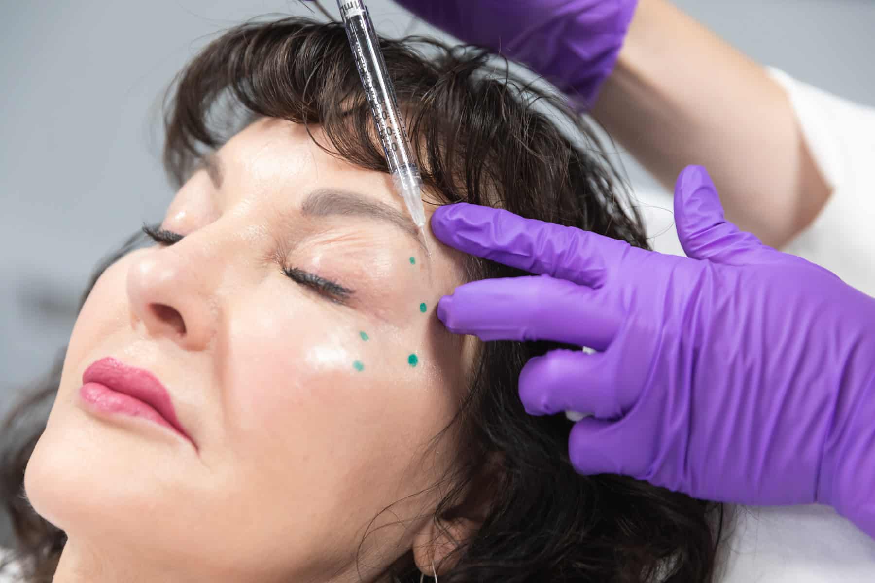 woman being treated with Botox
