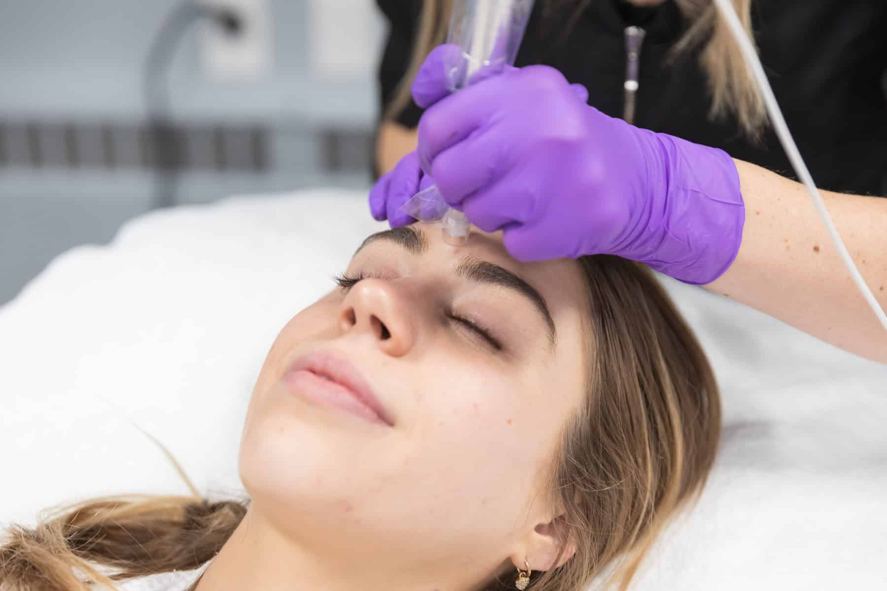 woman being treated with micro-needling